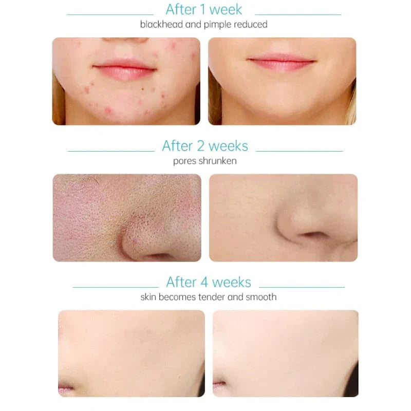 Amino Acid Face Cleanser, Facial Wash for Deep Clean